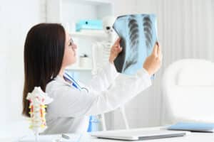 mulher segurando exame de imagem do pulmao